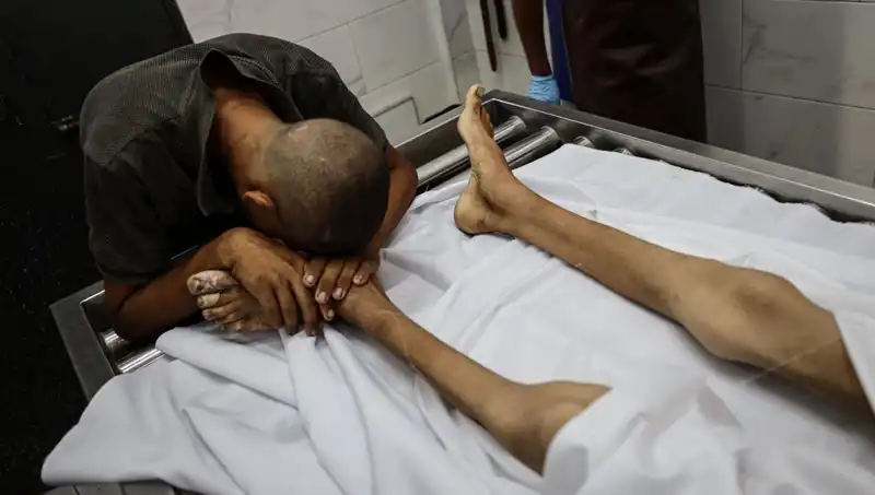Gazze'de Açlık Korkunç Boyutlara Ulaşıyor: Bir Çocuk Daha Hayata Veda Etti