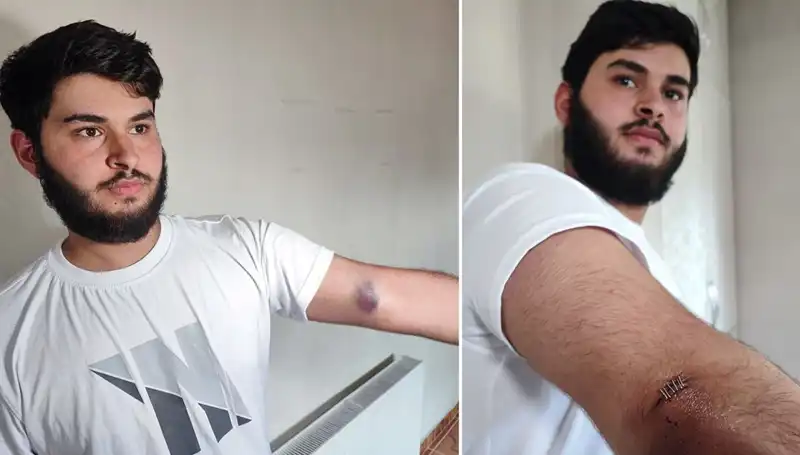Bahçeye Kaçan Top, Yüzlerce Kişiyi Durduran Olayı Başlattı!